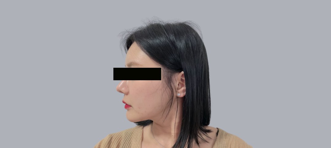 After