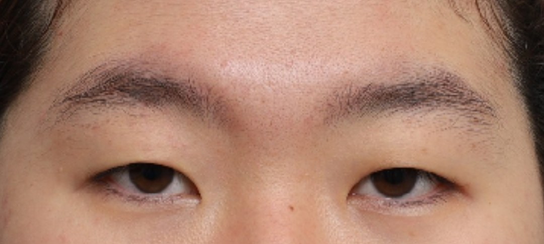 Before